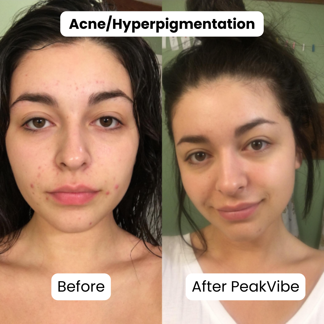 PeakVibe Natural Jiyu Toner Pads™